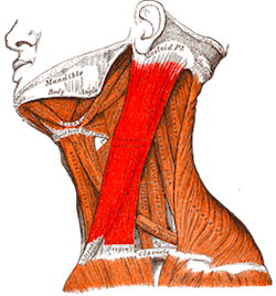 An anatomical diagram showing the location of the sternocleidomastoid muscle on the side of the neck.