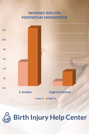 Chart for Incidence rate for Postpartum Endometritis